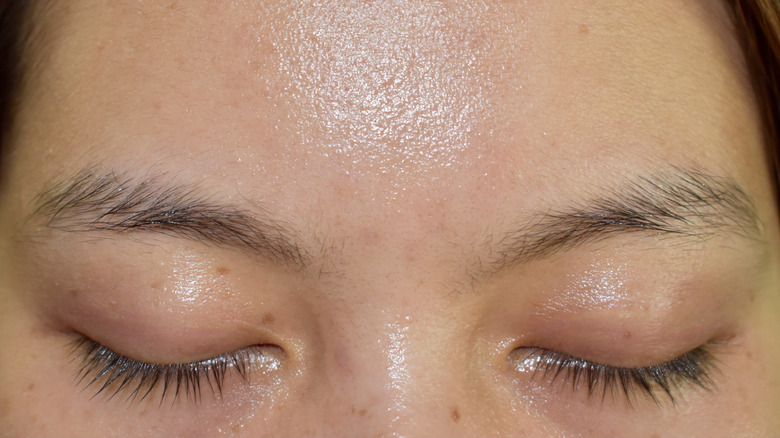 Woman with oily eyelids and forehead
