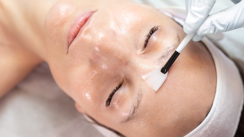 Chemical peel on face