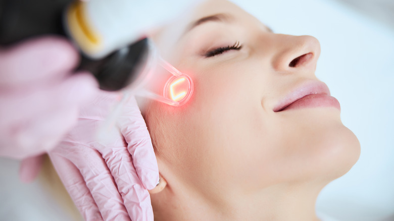 Facial laser treatment 