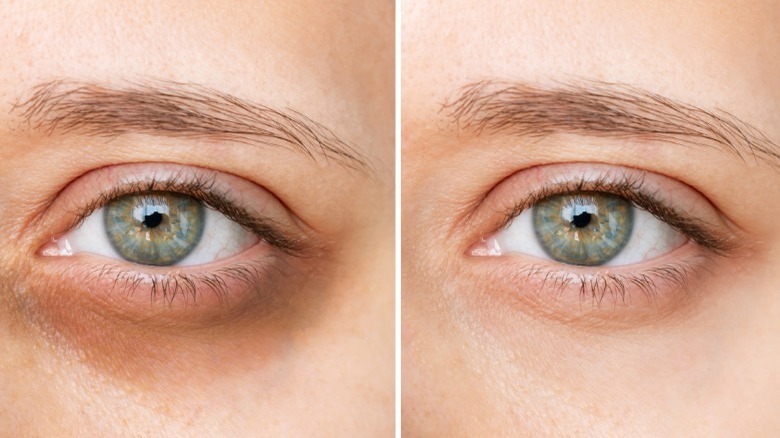 Skin with and without concealer