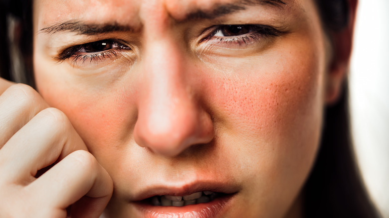 Girl suffering from irritated skin