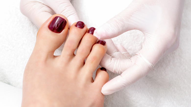 Woman with dark red toenails