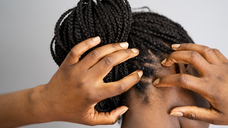 Girl with dry scalp.