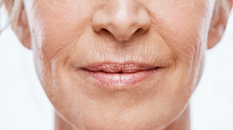 woman with mouth wrinkles