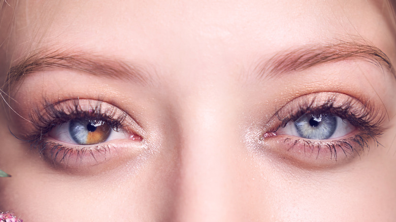 Woman's eyes with heterochromia