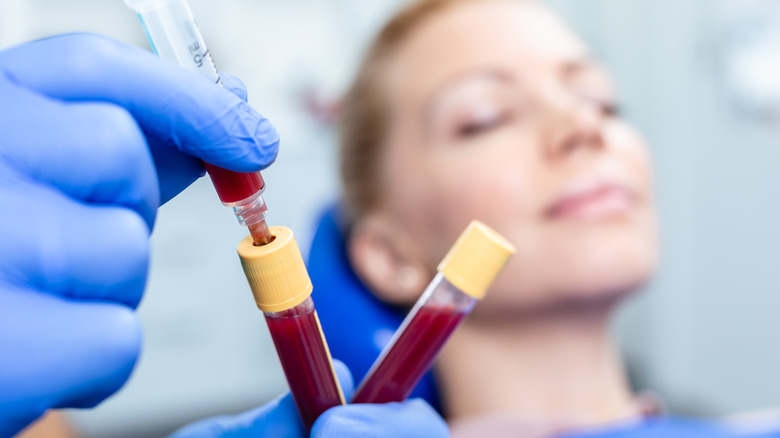 Blood vials before PRP therapy