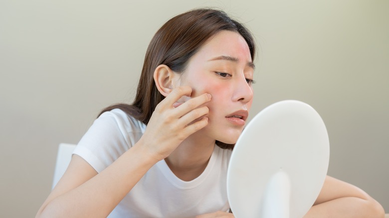 Woman looking in the mirror with allergic reaction 