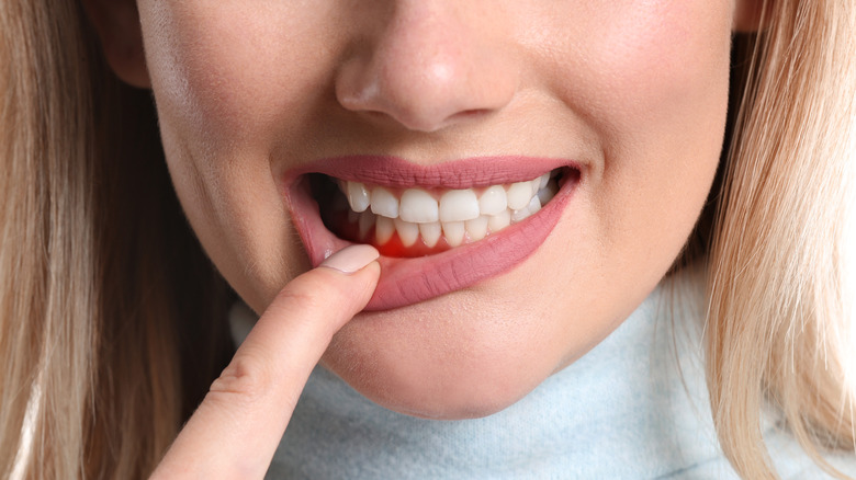 woman with gum inflammation red gums