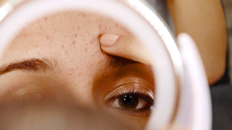 Woman examining acne in mirror