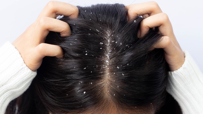 Woman itching her scalp