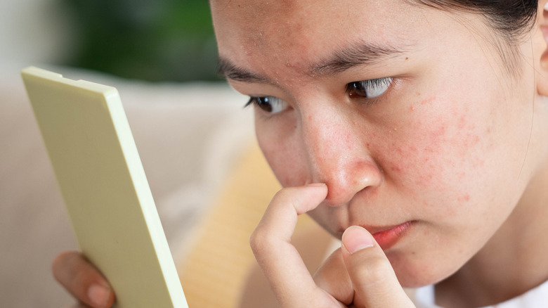 Woman examining pimples