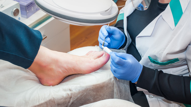 doctor treating ingrown toenail