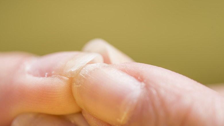 damaged nails