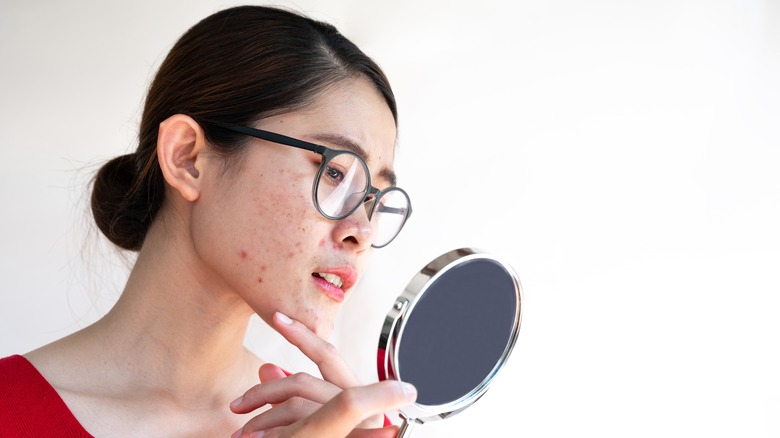 Woman with acne looking at reflection