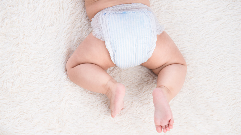 Birthmark on baby's legs