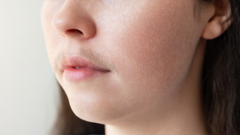 Woman with hair on upper lip