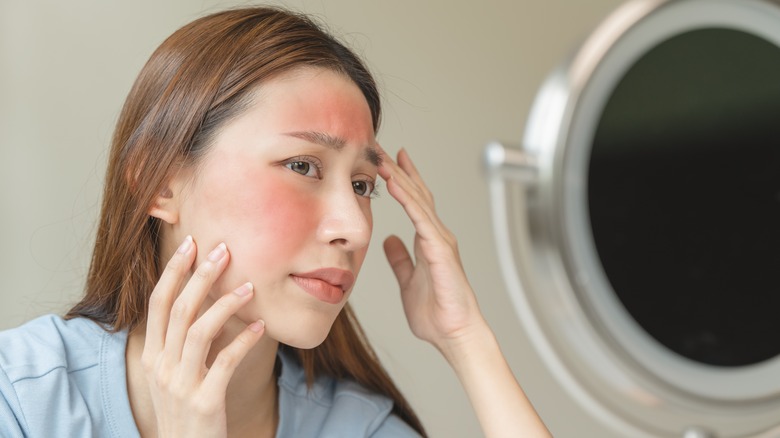 Women looking at red, blotchy skin