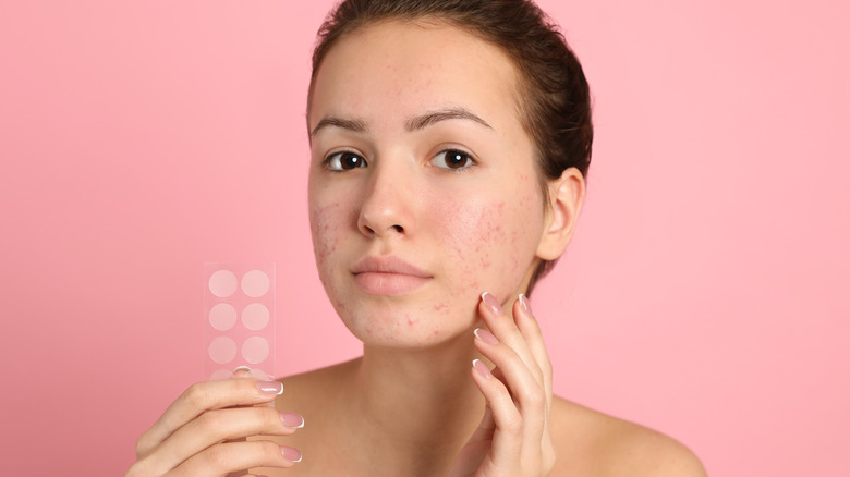 Woman holding up a strip of hydrocolloid acne patches