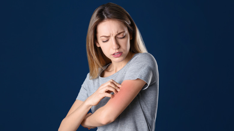 Woman with rash on arm