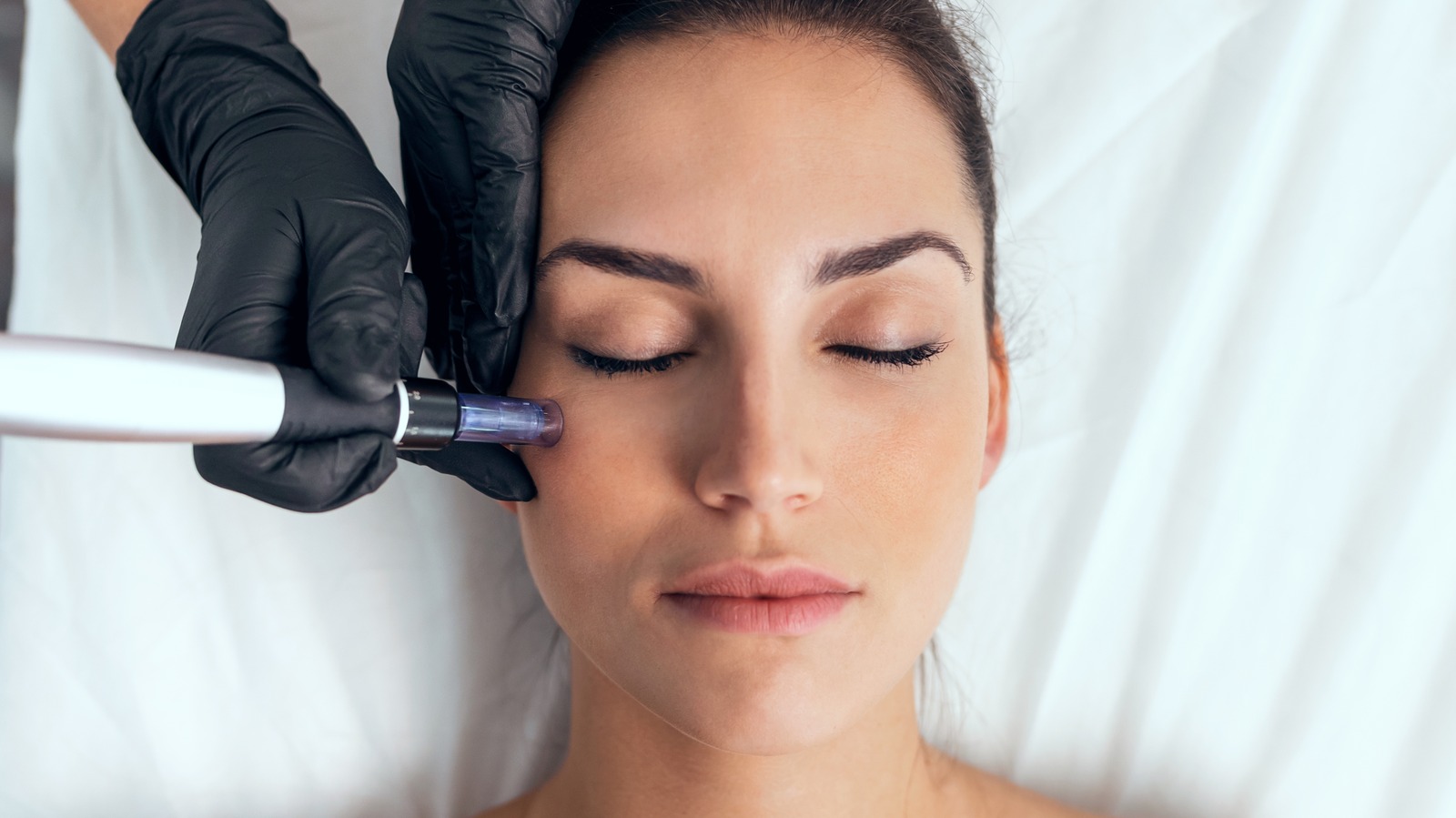 what-are-the-dangers-of-microneedling