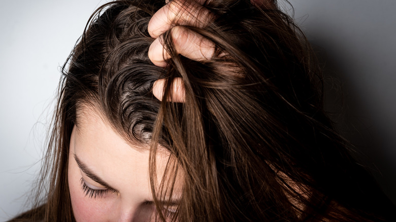 Closeup of oily hair and scalp