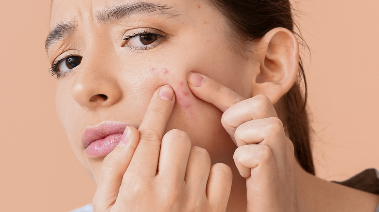 female picking at her acne