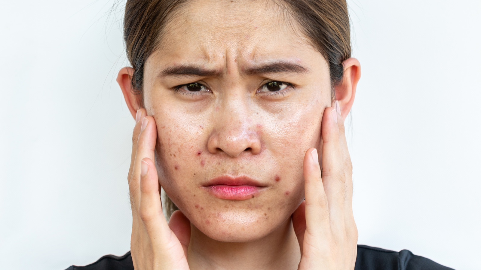 What Does It Really Mean To Have Clogged Pores 