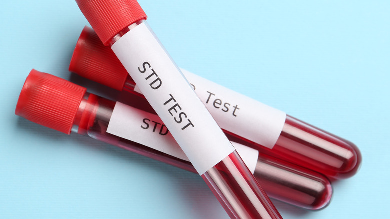 STD test vials