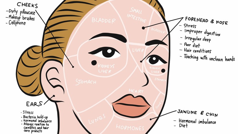 face mapping for acne