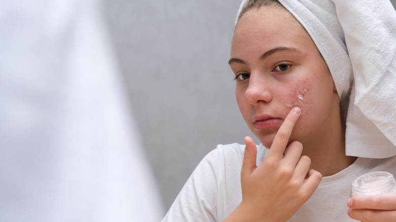 person applying acne cream