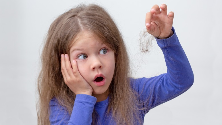 Child with alopecia hair loss