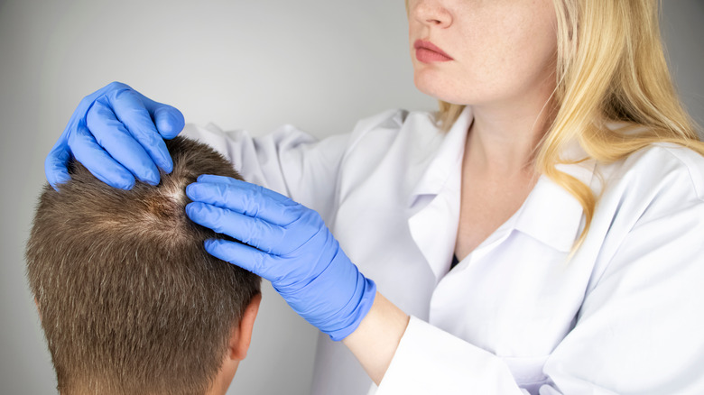 Doctor examining patient with alopecia