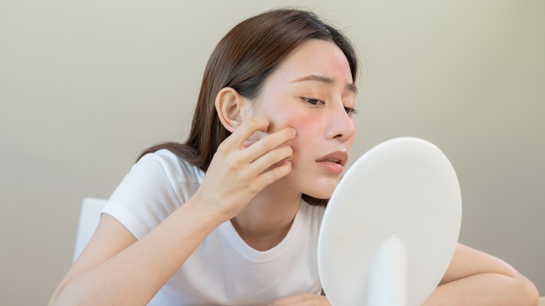 Woman with rash on face
