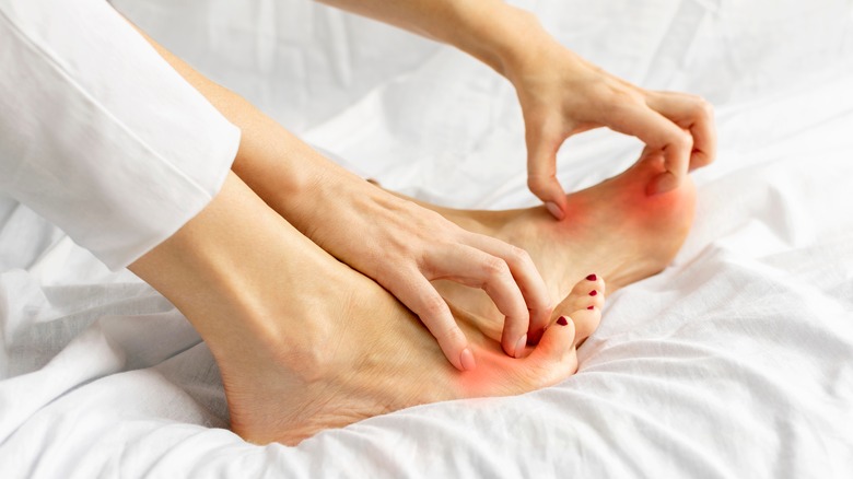 Woman itching feet on bed