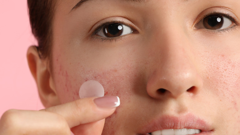 woman applying pimple patch