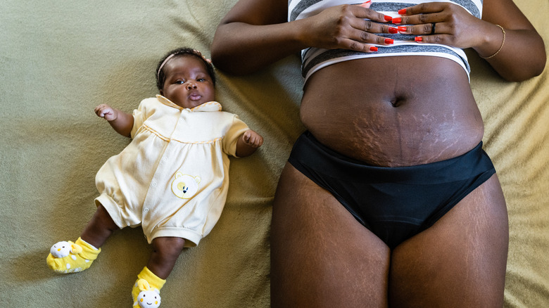 mother with stretch marks beside baby