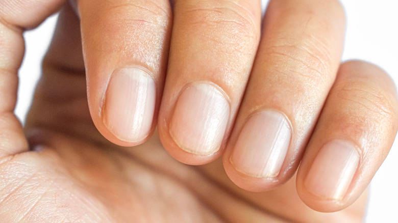 fingernails with ridges