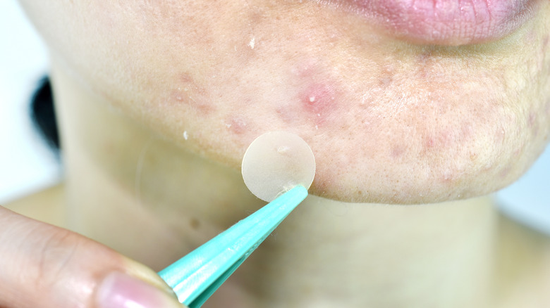 woman applying pimple patch