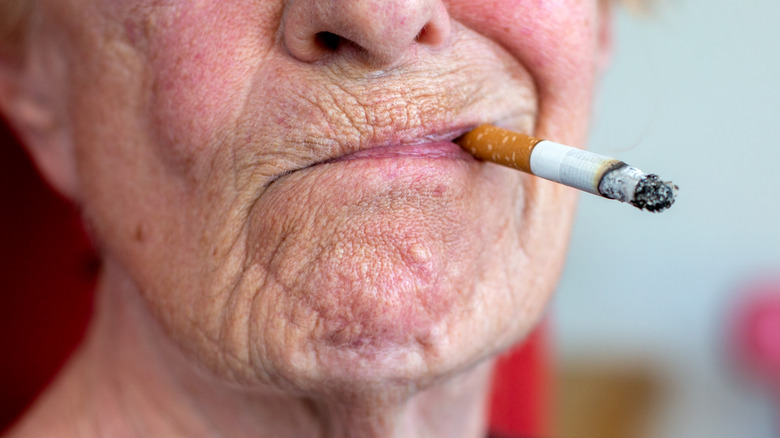 Woman with smoker's wrinkles