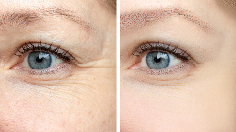 anti-aging before and after