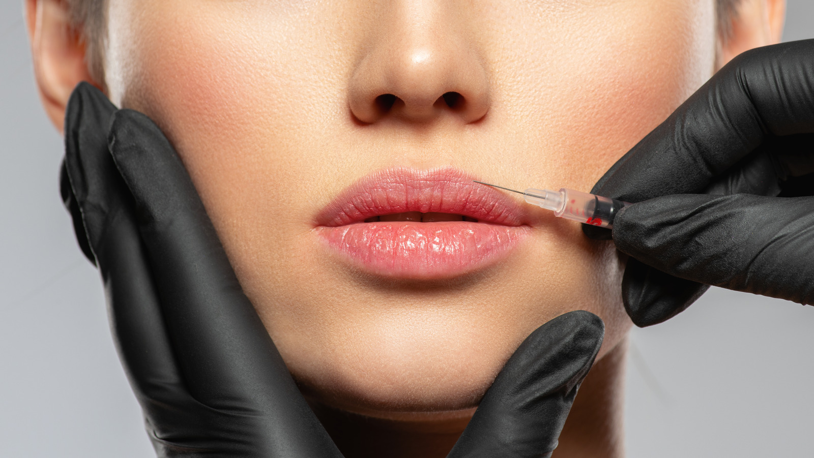 What To Expect When Getting Lip Filler Injections