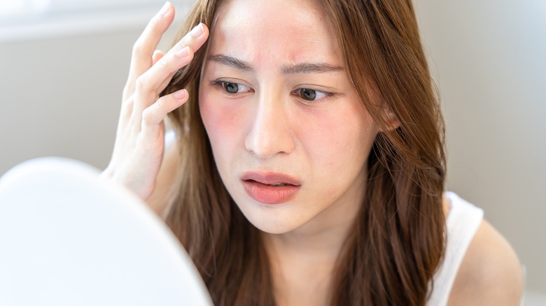 Woman looking at red skin in mirror