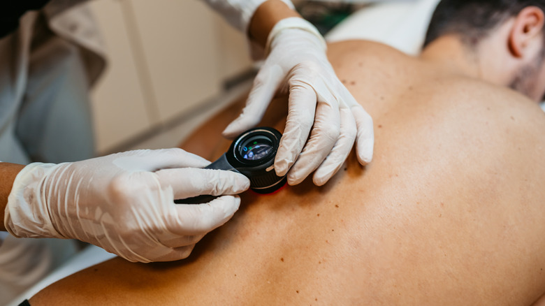 Doctor performing a skin check