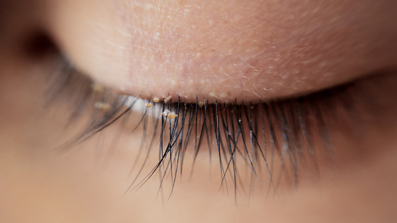 woman's eyelashes with lash mites