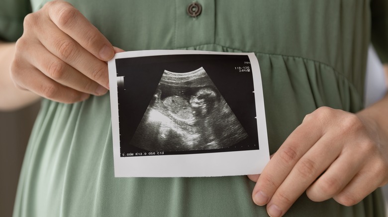hands hold an ultrasound photo