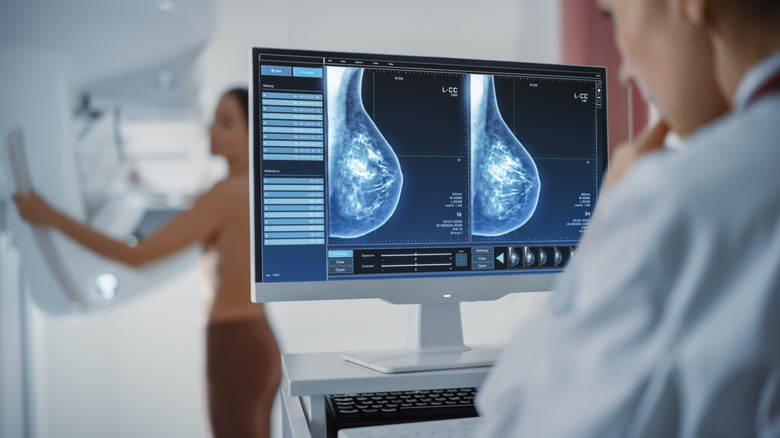 Radiologist examining mammograms on computer
