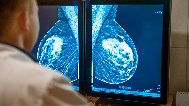 Radiologist viewing mammograms on computer 