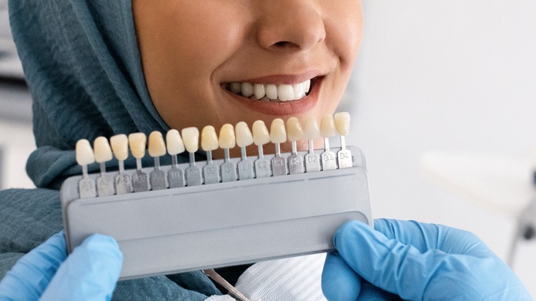 Color-matching dental veneers