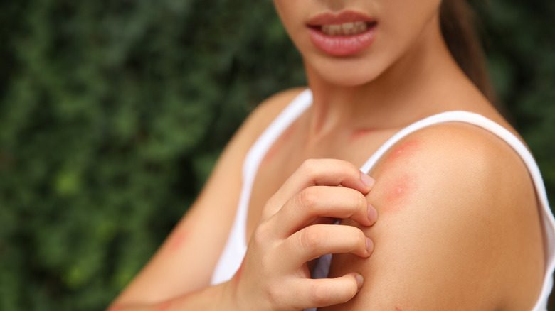 woman scratching rash on shoulder