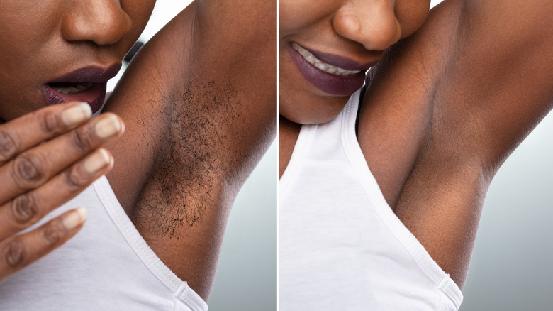 before and after of woman's armpits